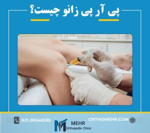 پی آر پی زانو چیست