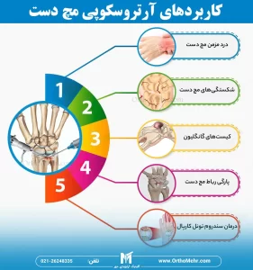 عمل آرتروسکوپی مچ دست چیست و چه کاربردی دارد